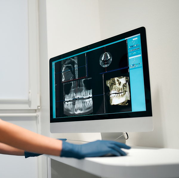 Looking at X rays of teeth on computer monitor