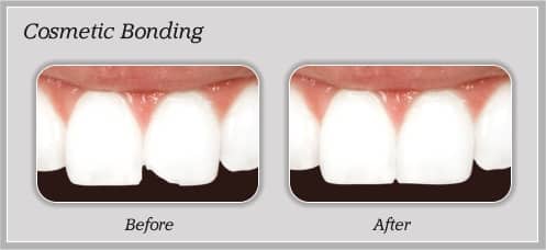 before_after_03