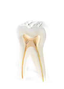 root canal therapy can save your tooth