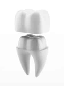 smithdentalcrowns