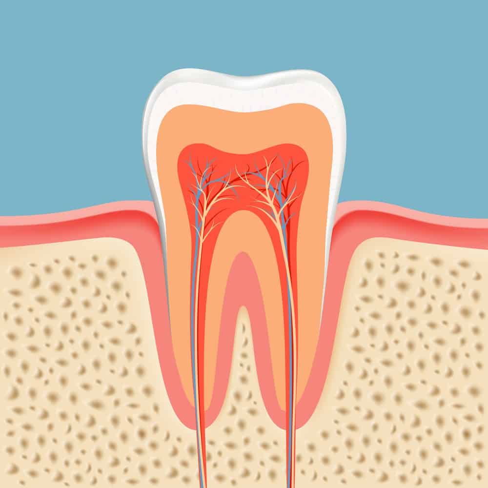 does-a-big-cavity-mean-root-canal