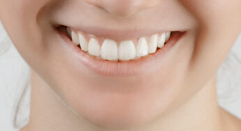 Cosmetic Dentistry Can Help Your Smile Shine