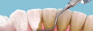 grand prairie periodontics