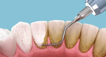 Keeping Your Gums Healthy And Strong