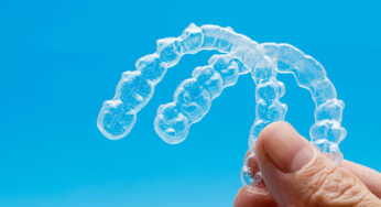Straightening Your Smile With SureSmile