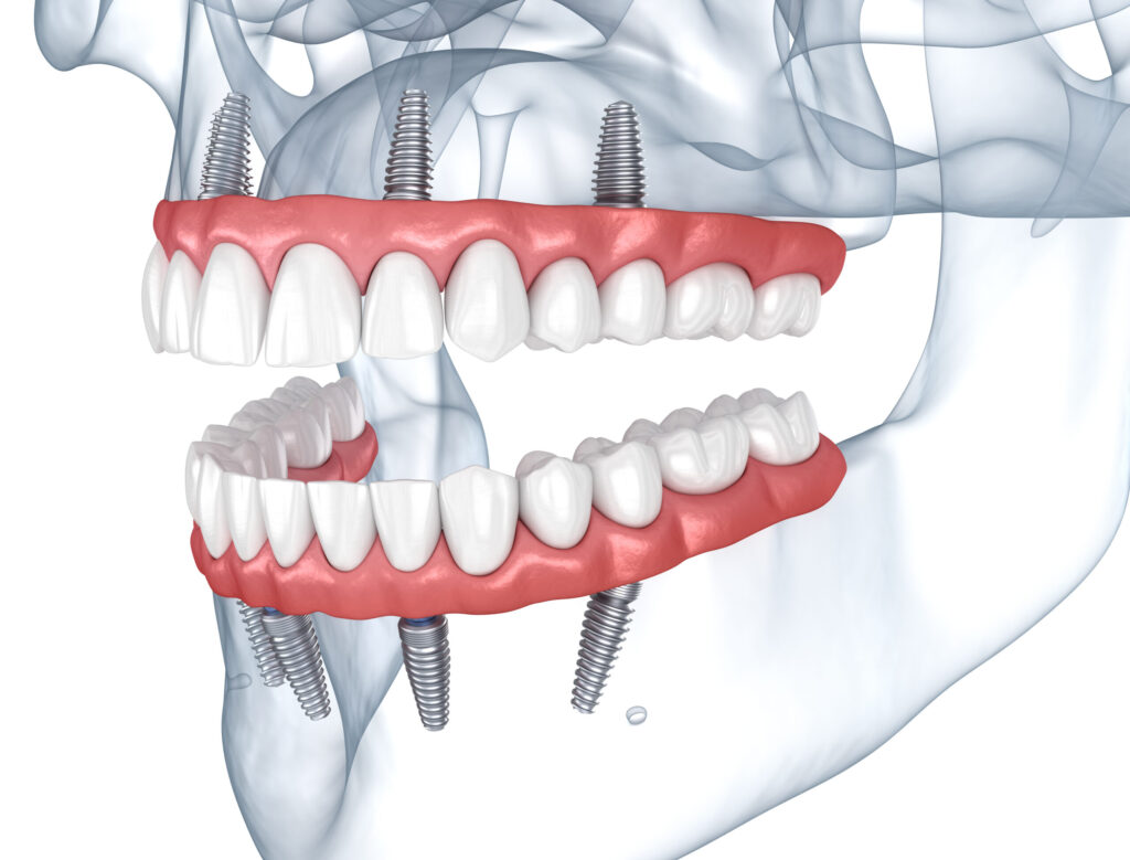 grand prairie prosthetic dentistry