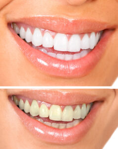 grand prairie cosmetic dentistry