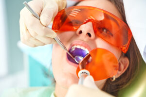 grand prairie dental filling