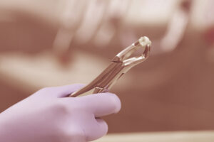 grand prairie tooth extraction