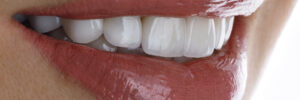 grand prairie full mouth rehabilitation