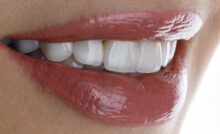 grand prairie full mouth rehabilitation