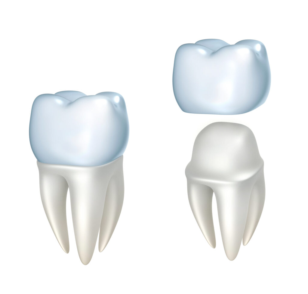 grand prairie restorative dentistry