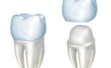grand prairie restorative dentistry