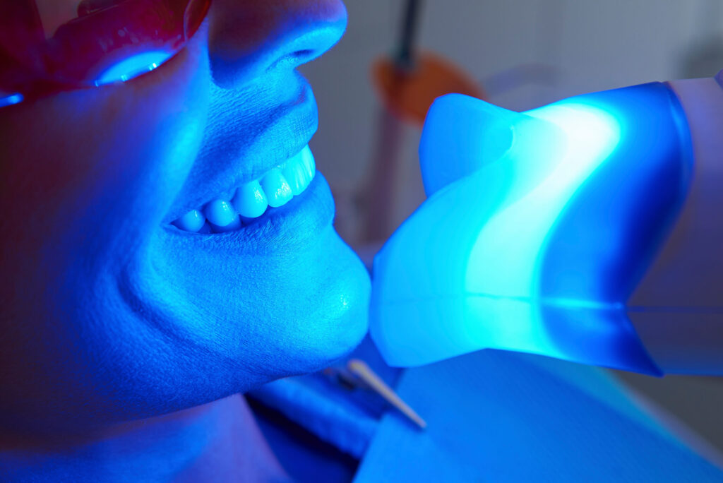 grand prairie teeth whitening