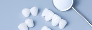 grand prairie veneers