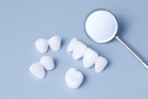 grand prairie veneers