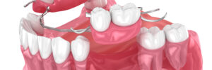 grand prairie dentures