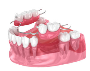 grand prairie dentures