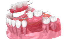 grand prairie dentures