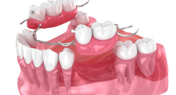 Dentures Can Help You Smile With Confidence