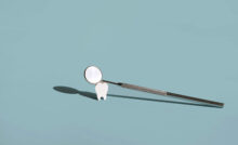 grand prairie dental filling