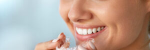 grand prairie teeth whitening