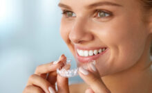 grand prairie teeth whitening
