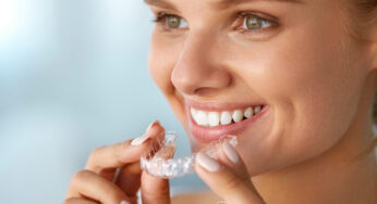 Try Our Take-Home Whitening Kit
