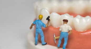 How We Restore Teeth With Lifelike Bonding
