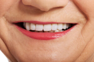 grand prairie full mouth rehabilitation