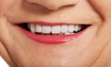 grand prairie full mouth rehabilitation