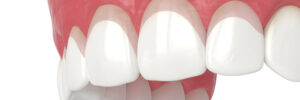 grand prairie gum contouring
