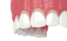 grand prairie gum contouring