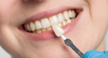 The Cosmetic Benefits Of Receiving Porcelain Veneers