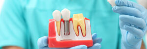 grand prairie restorative dentistry