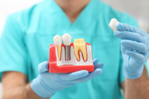 grand prairie restorative dentistry