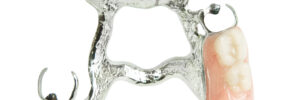 grand prairie partial dentures
