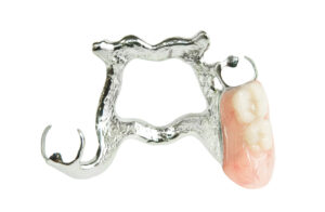 grand prairie partial dentures
