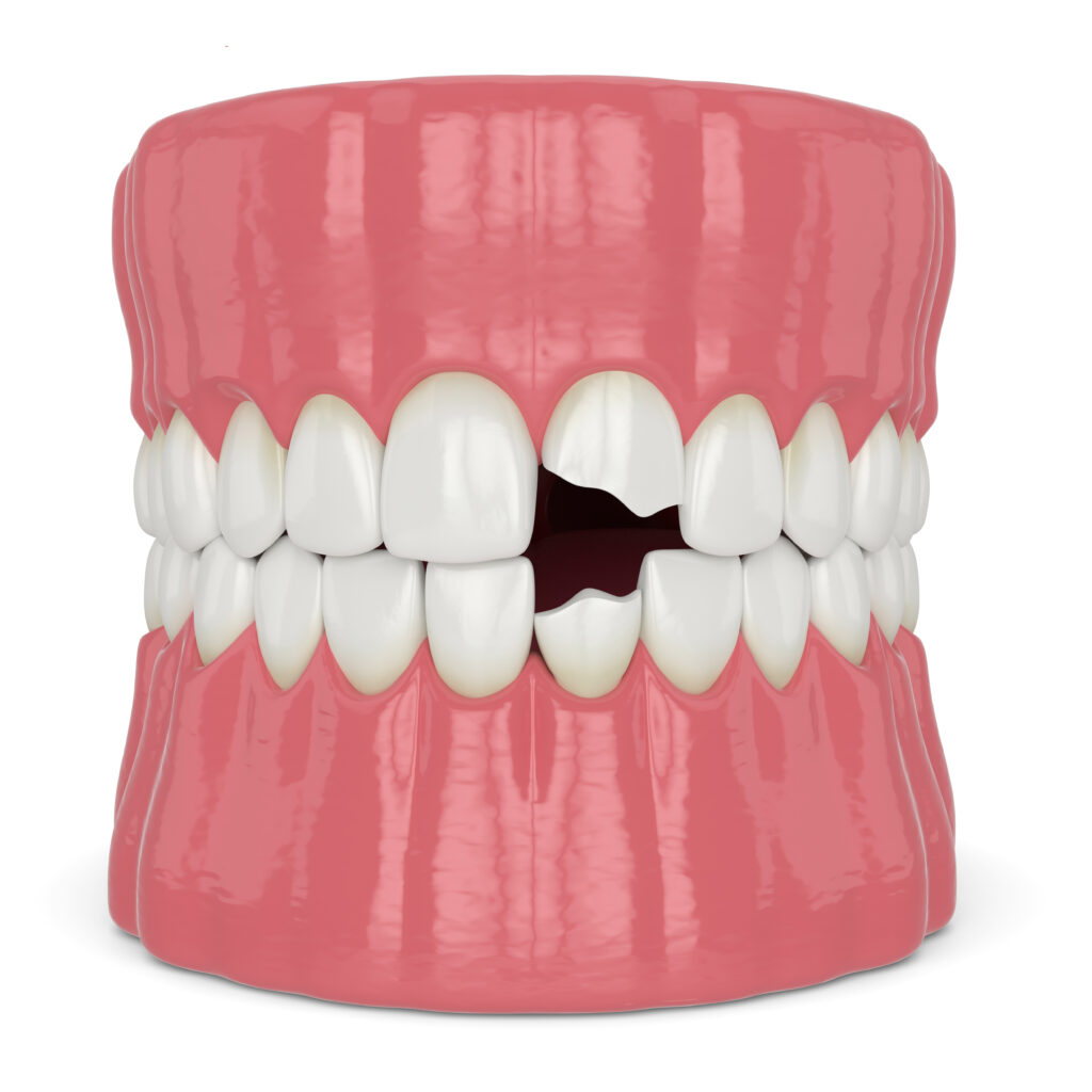 grand prairie dental emergency