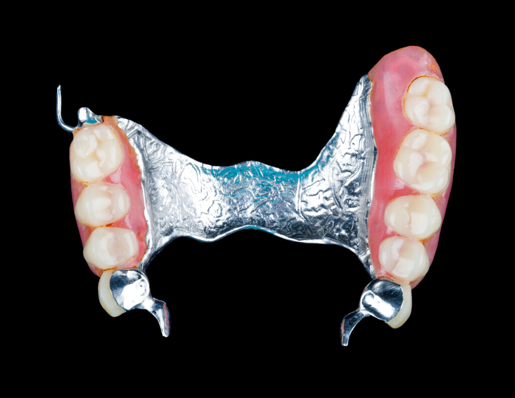 grand prairie partial dentures