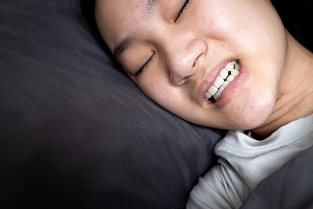 grand prairie bruxism