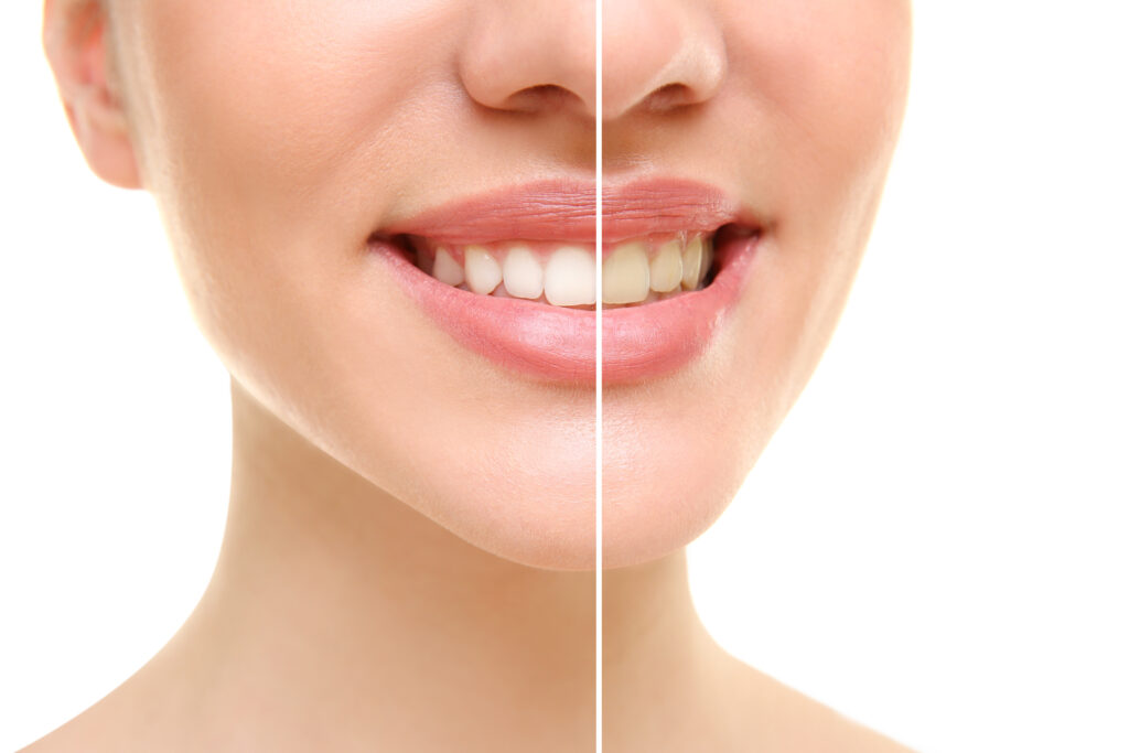 grand prairie cosmetic dentistry
