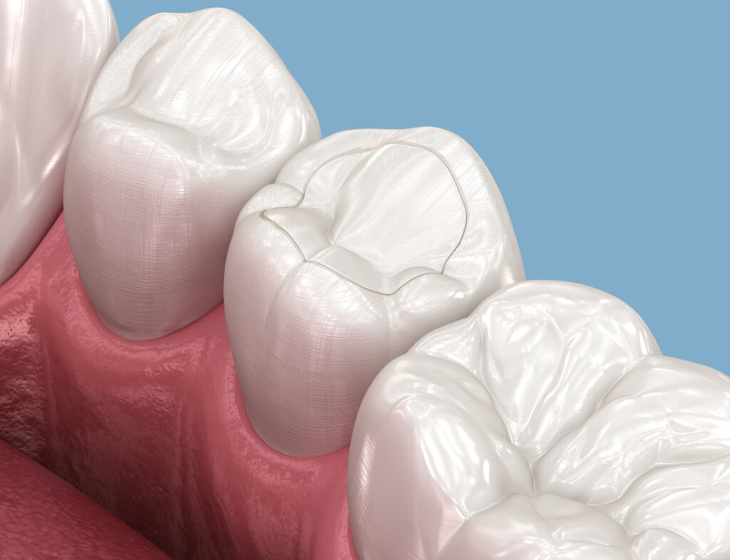 grand prairie restorative dentistry